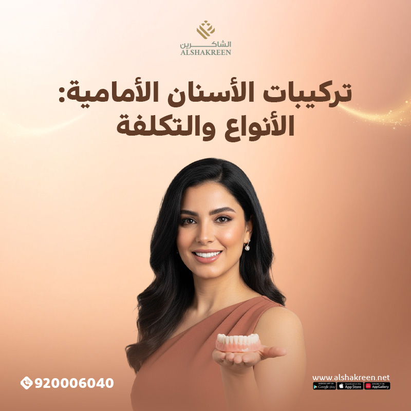 تركيبات الأسنان الأمامية