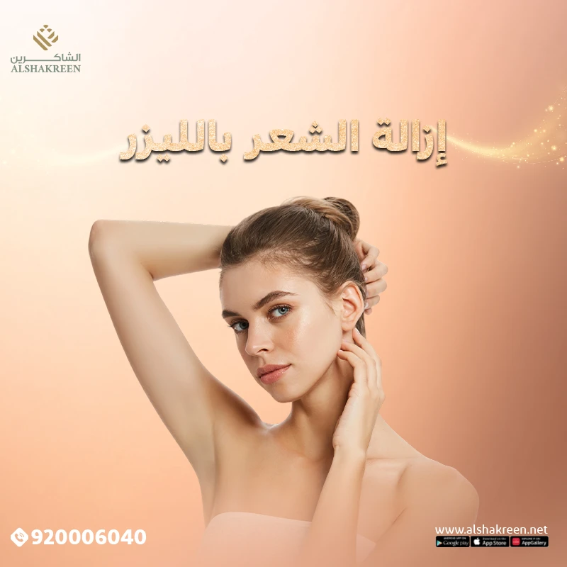 إزالة الشعر بالليزر في عيادات الشاكرين