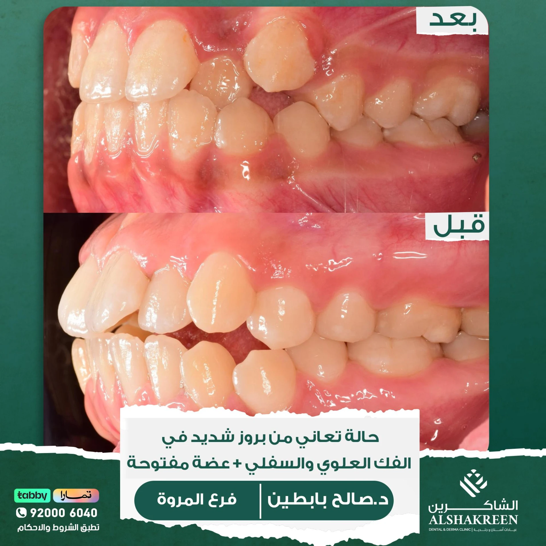 د. صالح عبدالعزيز بابطين