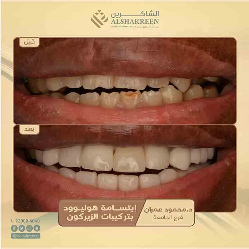 د. محمود مرسي