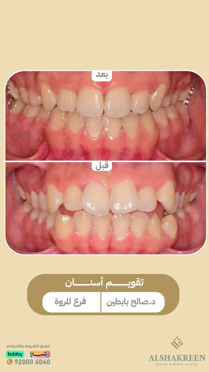 د. صالح عبدالعزيز بابطين