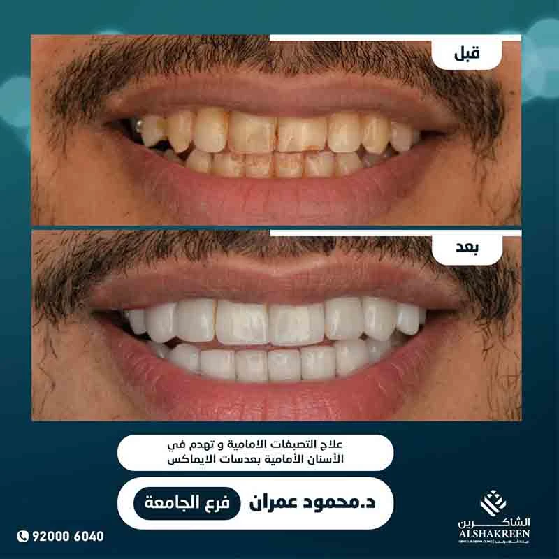د. محمود مرسي