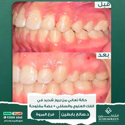 د. صالح عبدالعزيز بابطين