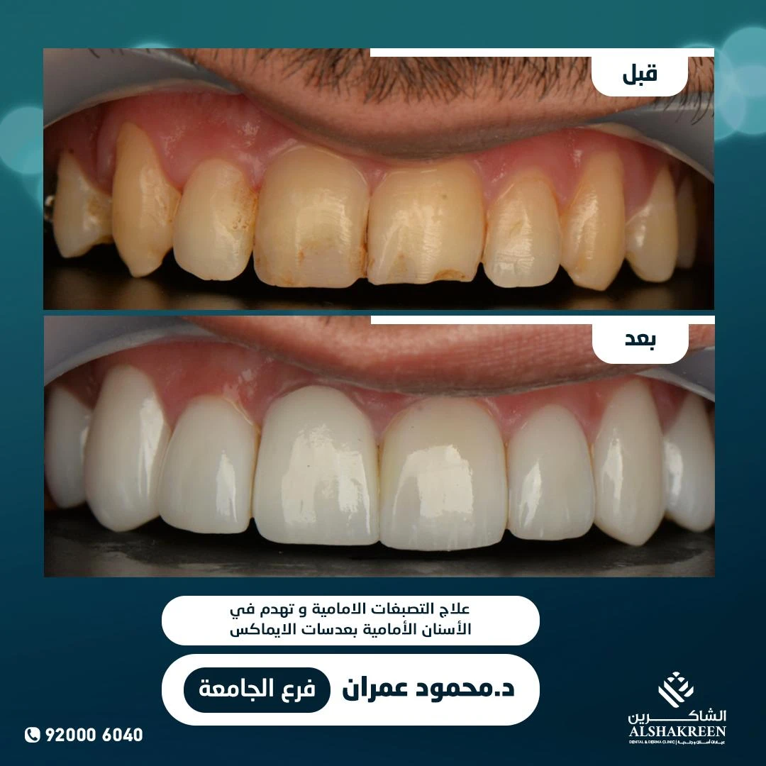 د. محمود مرسي