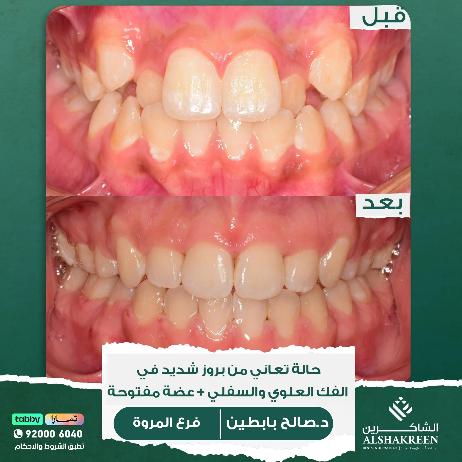 د. صالح عبدالعزيز بابطين