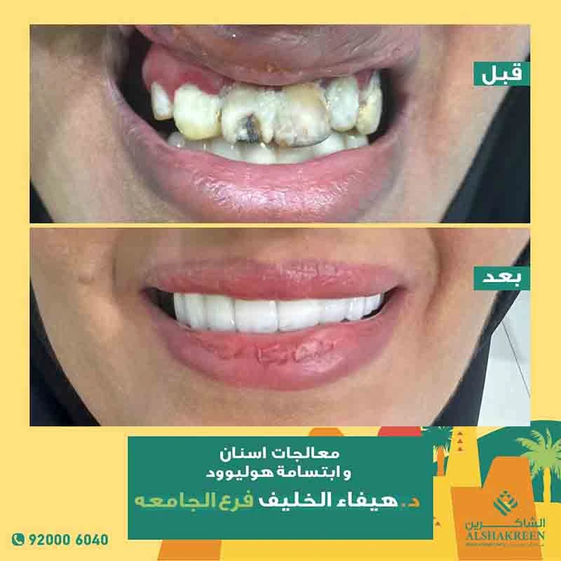 د. هيفاء خليف